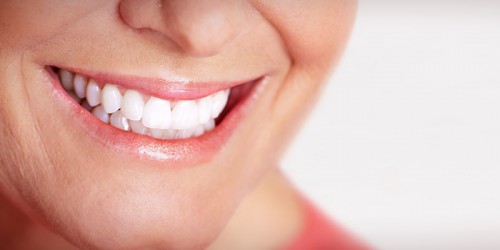 Què són els implants dentals