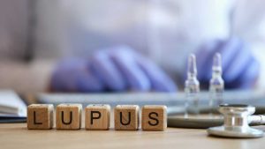 Més informació sobre l'article Com es manifesta el lupus