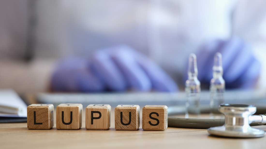 En este momento estás viendo Cómo se manifiesta el lupus