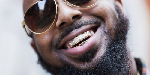 alt-joyas en los dientes-piezas dentales (1)