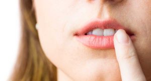 Lee más sobre el artículo ¿Por qué salen aftas o úlceras bucales?